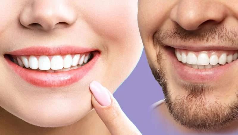 Sourire éclatant après blanchiment dentaire