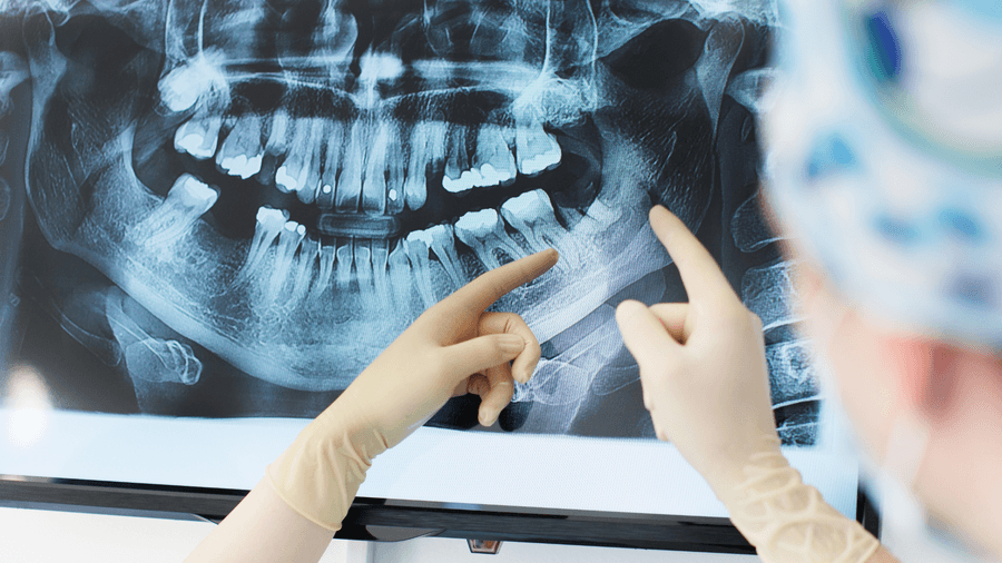 Radiologie Dentaire — imagerie et diagnostic numérique